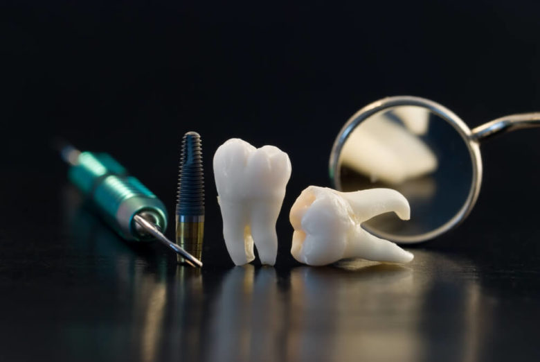 Odontologia Estética